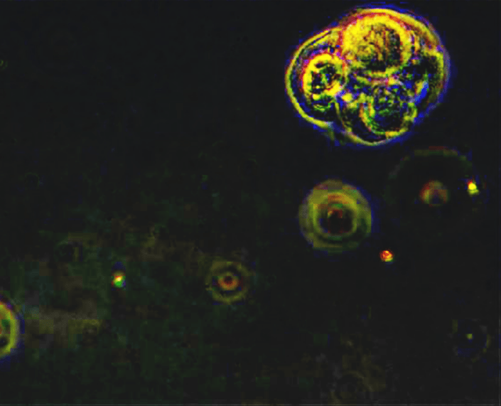 Where to Find Cancer-Associated Fibroblasts: The Master Remodelers of the Tumor Microenvironment