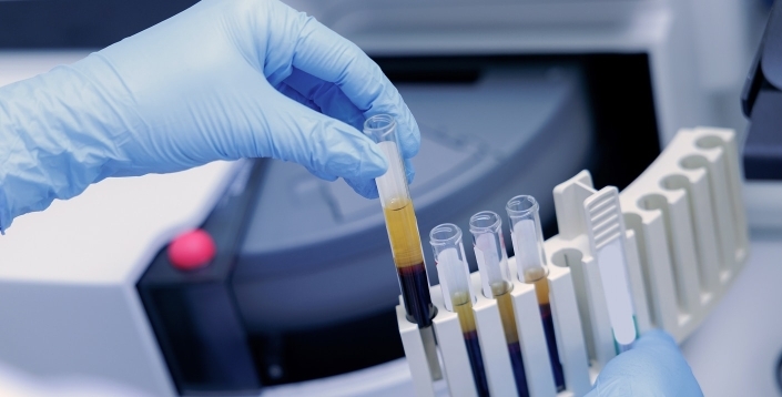 Biospecimens